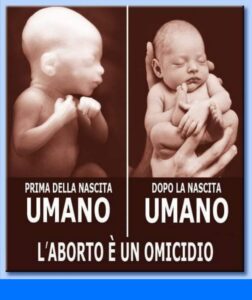 L’aborto è omicidio